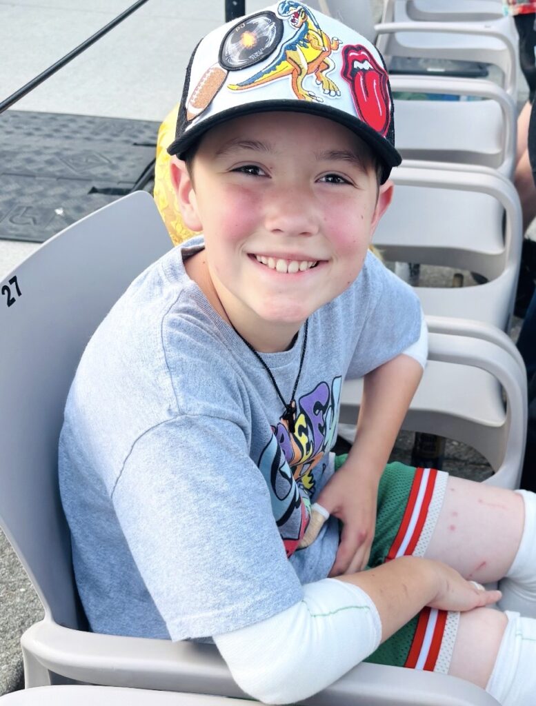 Patterson sits smiling, wearing a baseball cap and bandages, enjoying a happy moment.